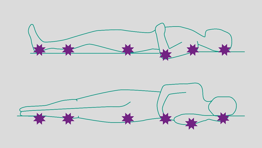 In a graphic of a lying person, the six different pressure ulcer points are shown from the feet to the head