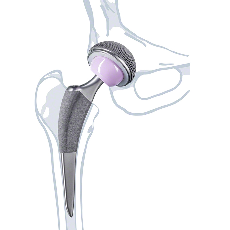Excia® T Hip Stem System