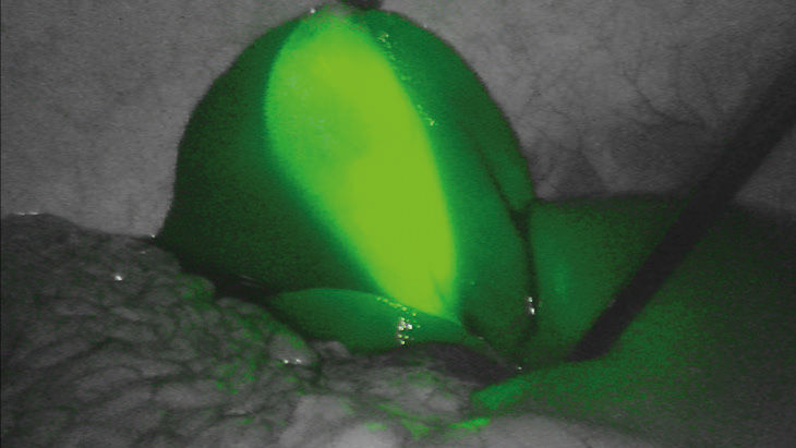FI green – 3D Fluorescence Imaging technology