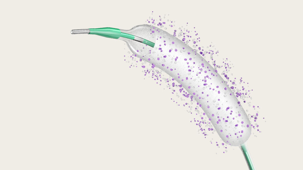 SeQuent® SCB – Sirolimus coated balloon