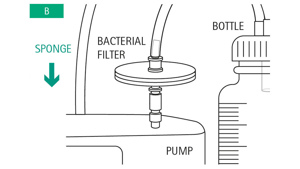 Illustration: Connect the filter using a Luer Lock to the pump. Then attach the cylinder hose from the secretion bottle to the filter.