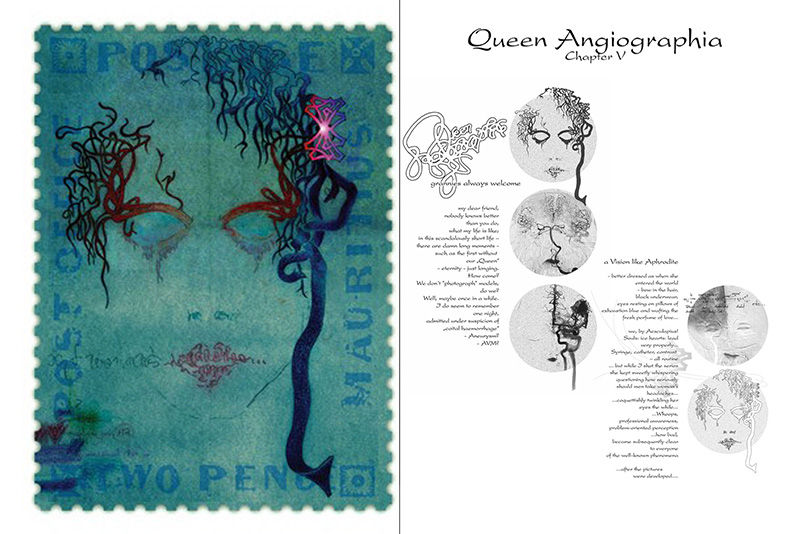 Miro Orszagh Book Chapter V Queen Angiographia