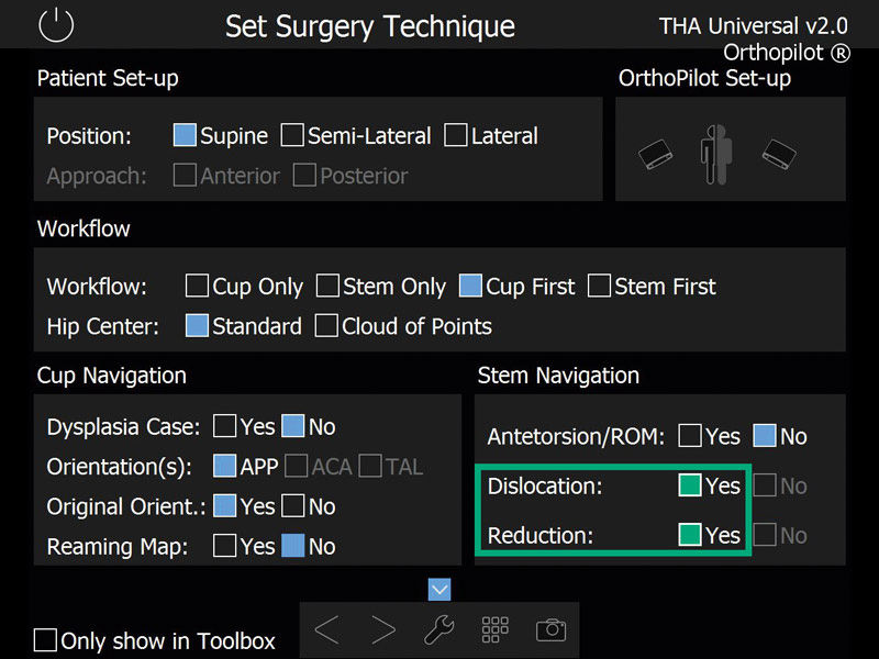 Screenshot THA APP navigation software hip arthroplasty