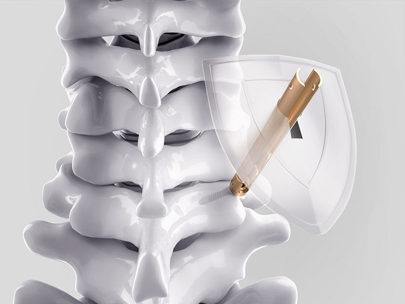 Ennovate® Cervical MIS – Minimal intervention. Enhanced protection.