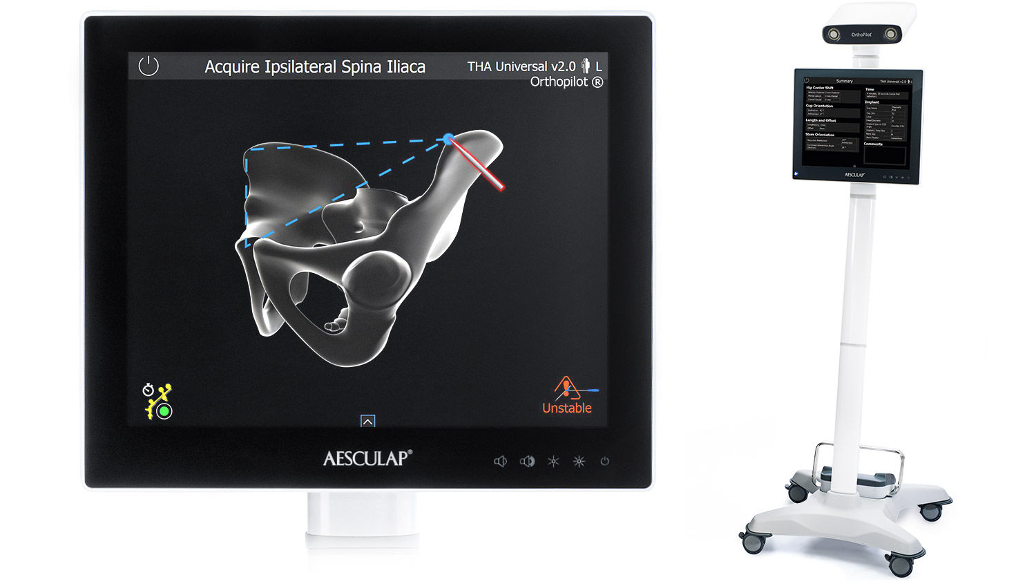 Screenshot Ipsilateral Spina Iliaca