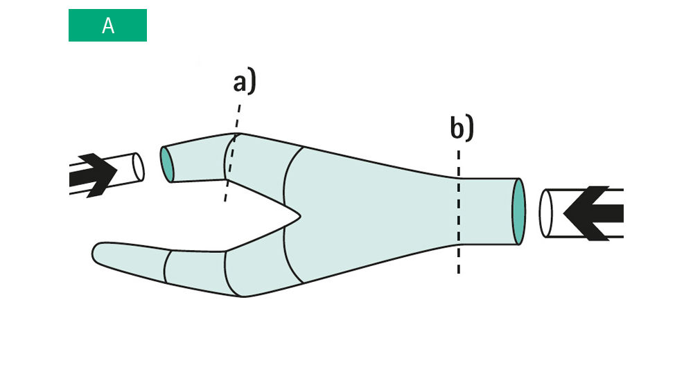 Illustration: a) The redon drain must be introduced in the Y-connector to the minimum depth marked by dashed line. b) The connection of the secretion bottle must be introduced in the Y connector to the minimum depth marked by dashed line.