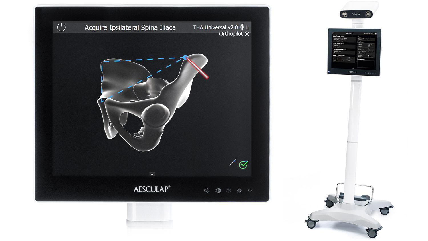 Screenshot Ipsilateral Spina Iliaca