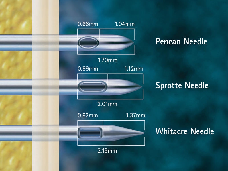 Illustration comparing Pencan, Sprotte, and Whitacre spinal needles with labeled tip designs and measurements in millimeters