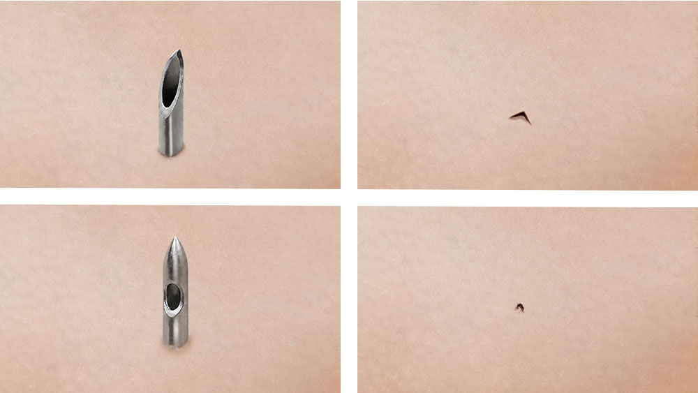 Close-up comparison of a needle tips and the small skin puncture left after insertion.