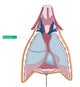 Pleural Space