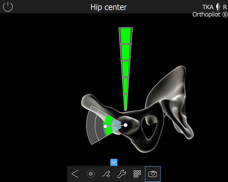 Screenshot of the OrthoPilot® TKA software – Hip center