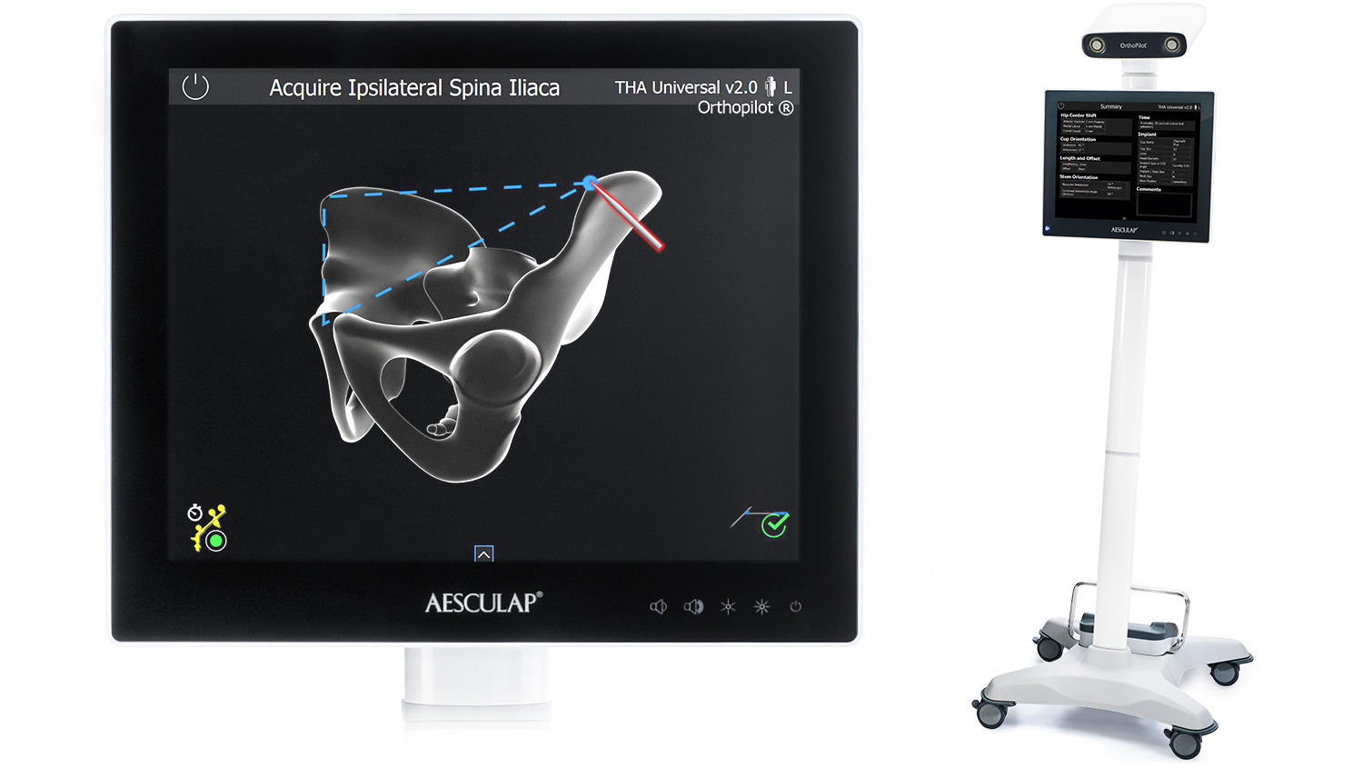 Screenshot acquire ipsilateral spina iliaca