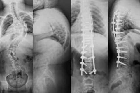 X-Rays of the spine with best Ennovate® practices