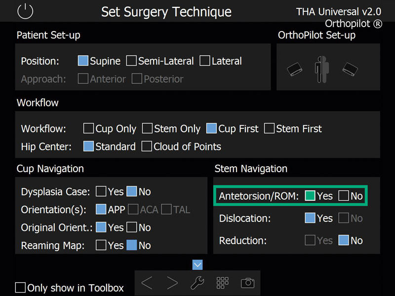 Screenshot THA Pro navigation software hip arthroplasty
