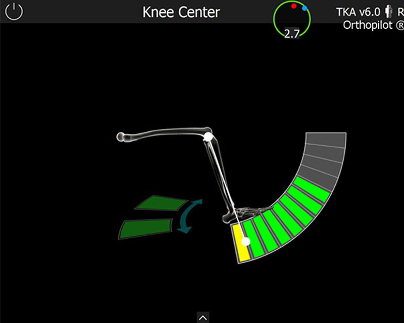 Screenshot of the OrthoPilot® TKA software – Knee center