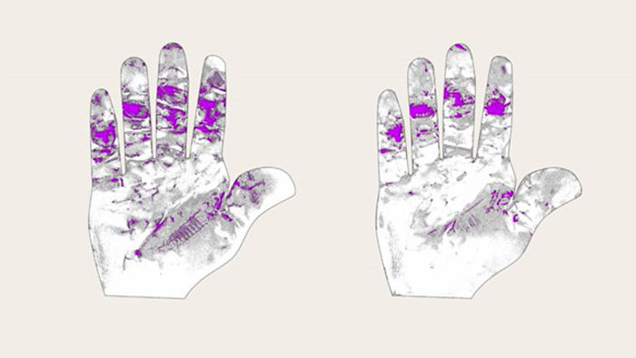 Two illustrations of a hand showing different zones of hand fatigue, highlighted in lila color