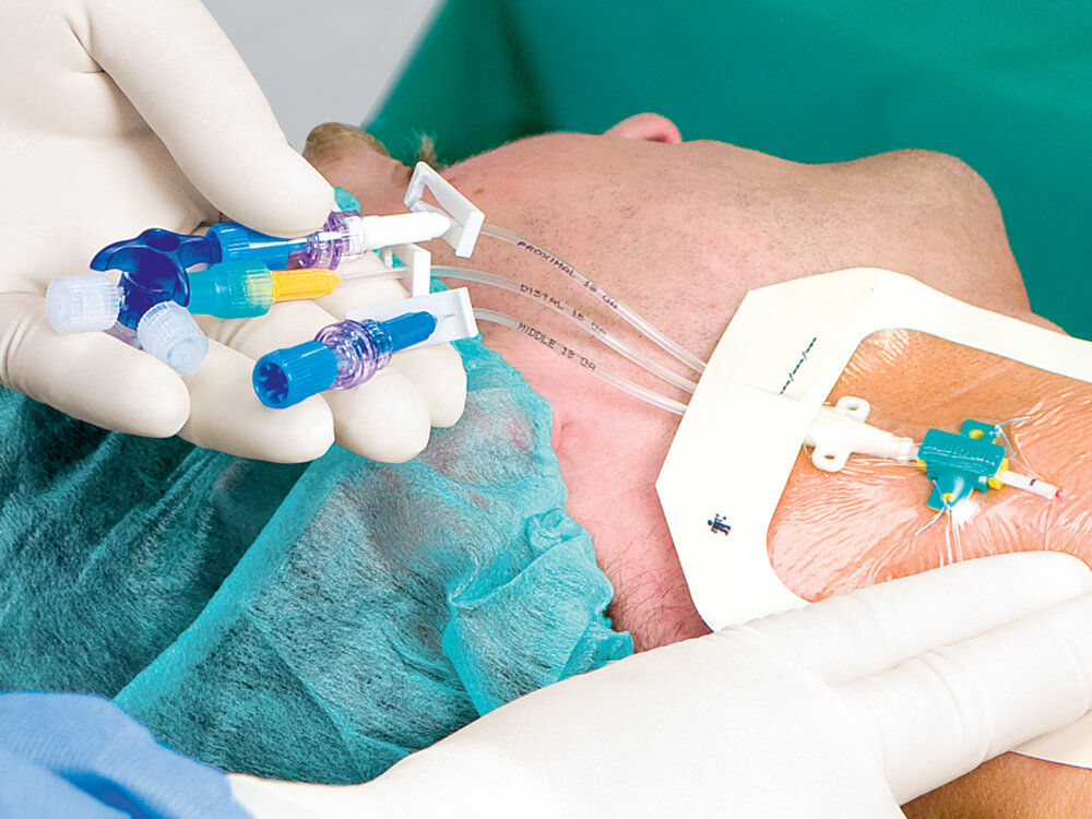Coverage of placed Certofix Trio catheter with transparent dressing - healthcare worker wearing gloves patient wearing green cap