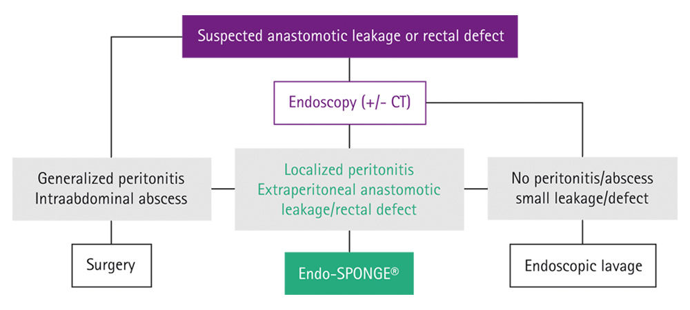 Chart of the Endo-SPONGE® indication decision tree