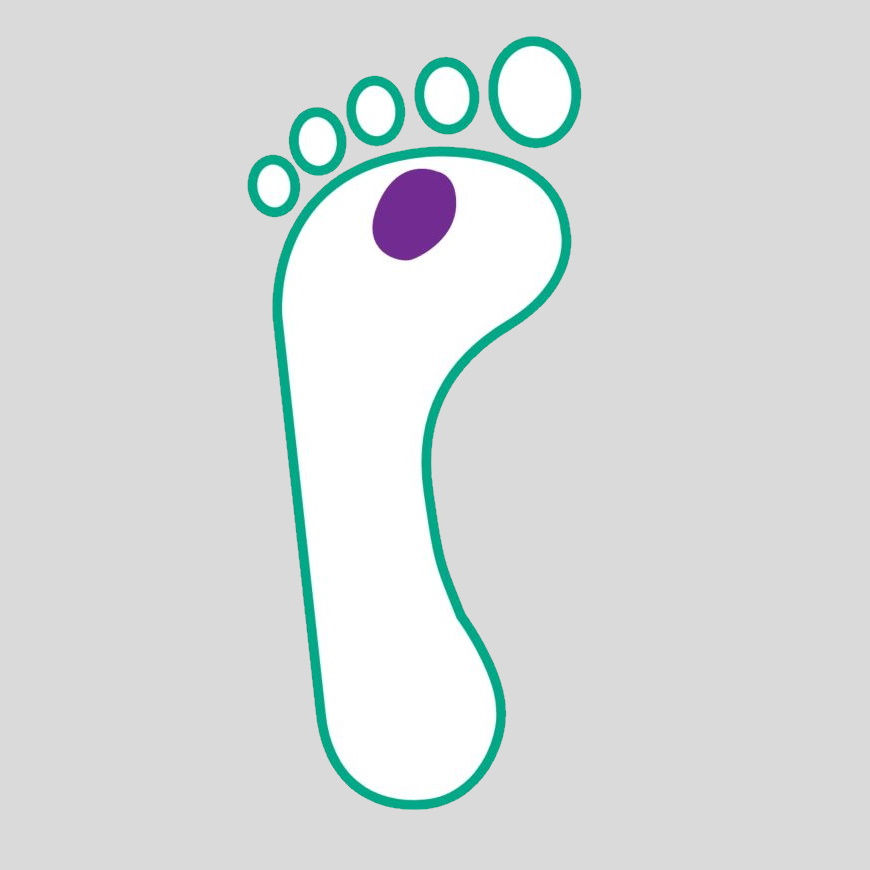 diabetic foot ulcer illustration grade 2