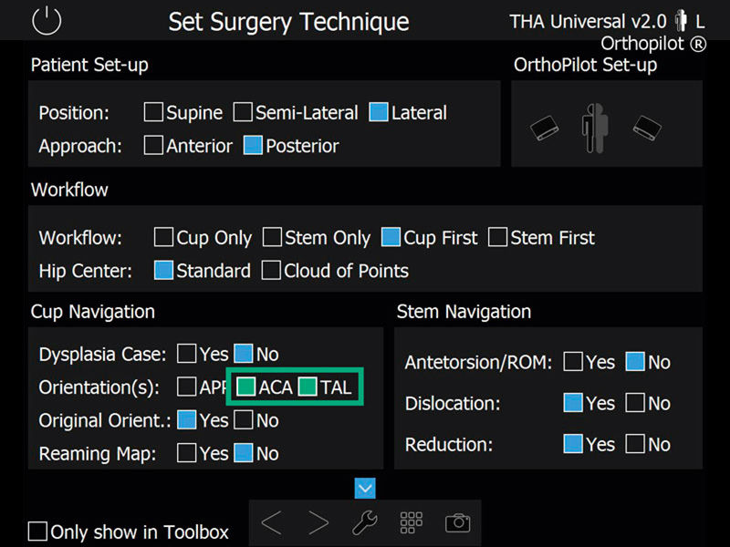 Screenshot THA ACA navigation software hip arthroplasty