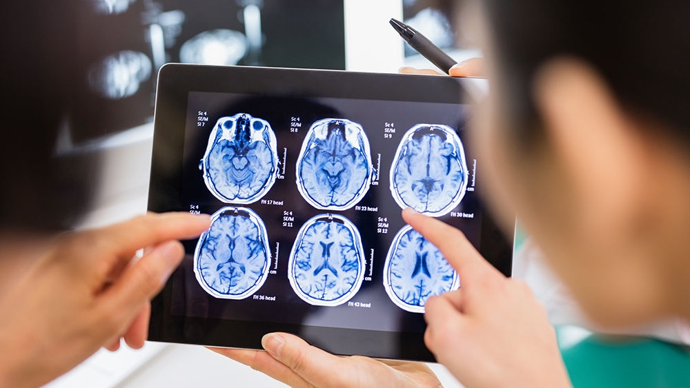 Two neurosurgeons looking at a x-ray of a brain