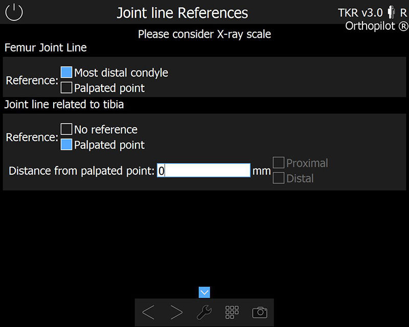 Screenshot of the OrthoPilot® TKR software – Joint line references