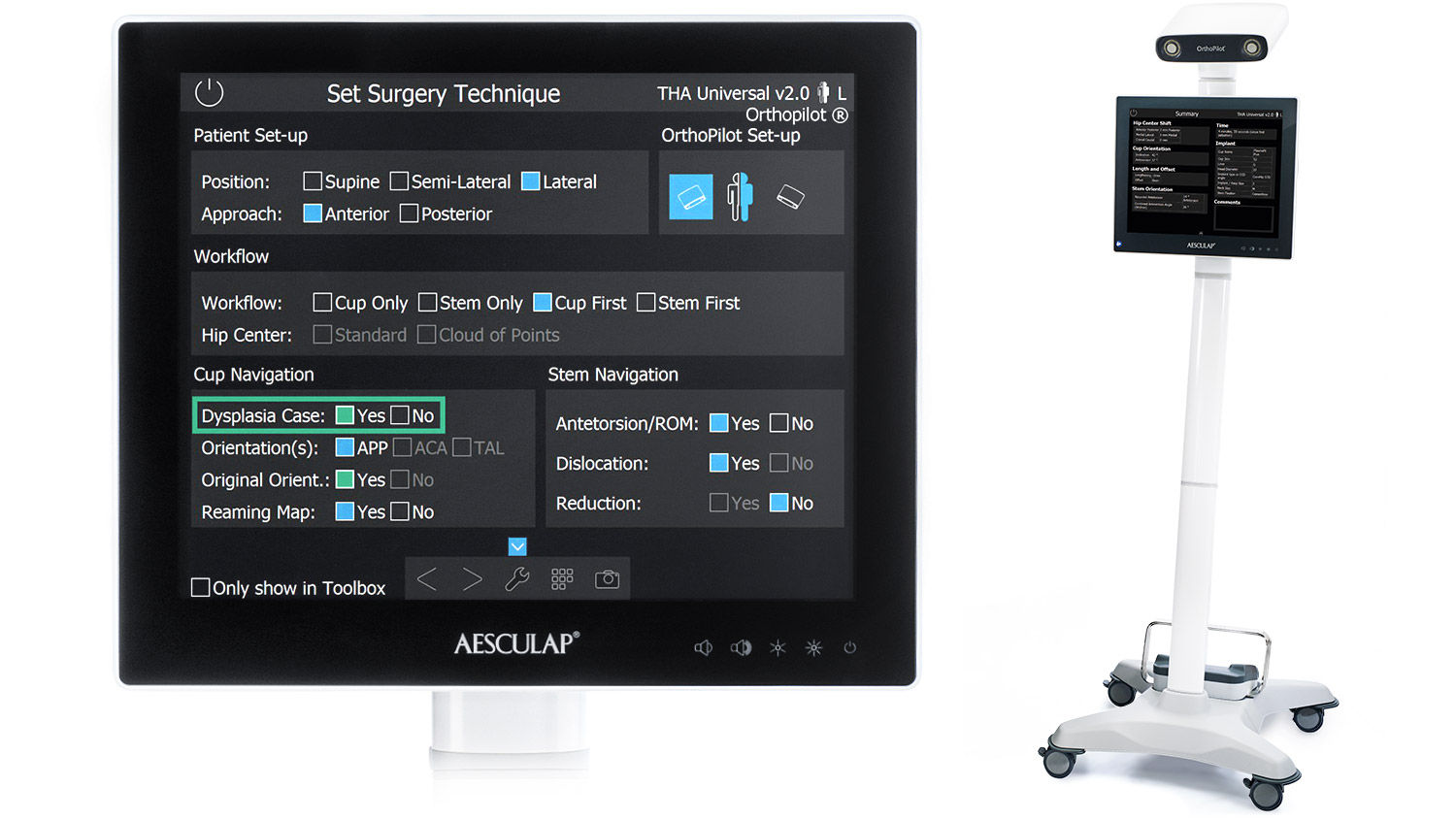 Screenshot Cup only navigation software hip arthroplasty