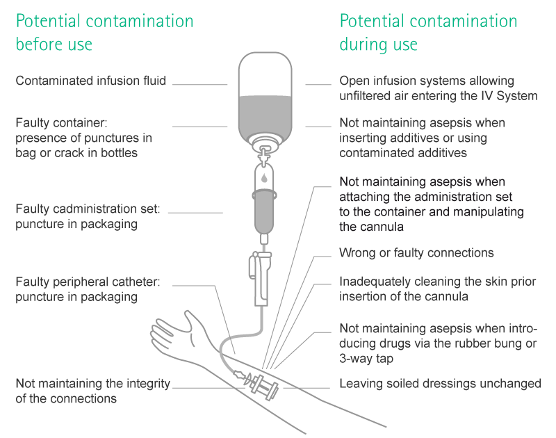 what is the most common route of contamination what is the most common route of contamination