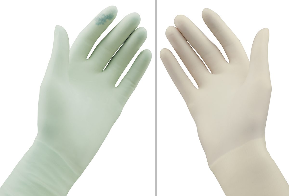 Comparative demonstration of perforation between double gloving with a green underglove (indicator system) and two white surgical gloves.