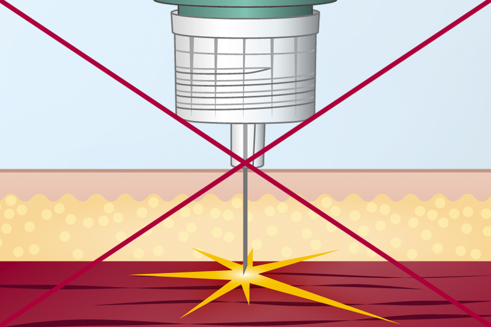 Needle length - don't
