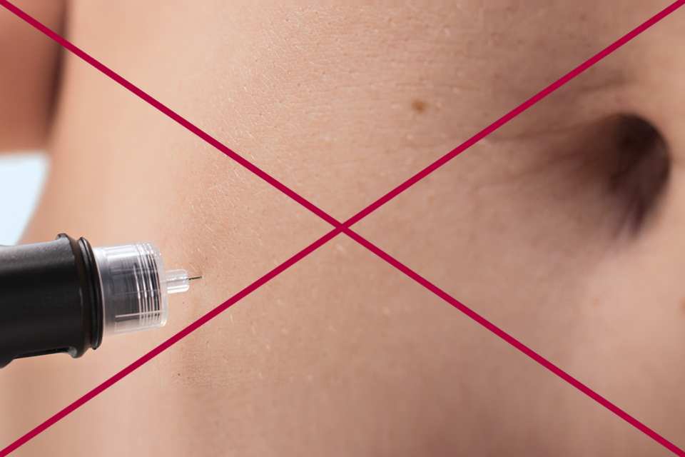 Needle insertion - don't