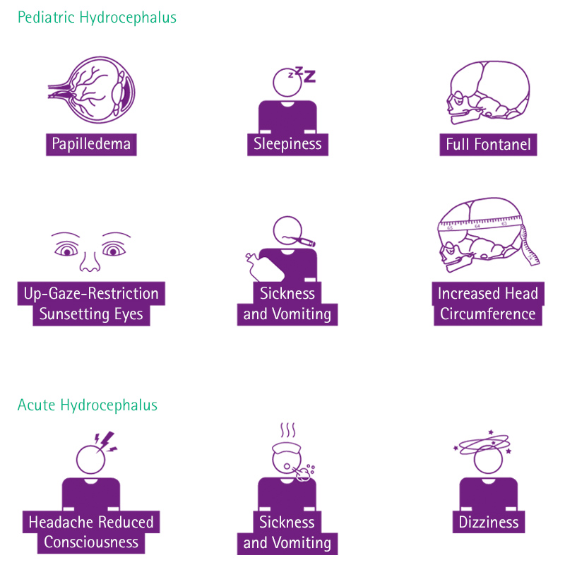 Understanding Hydrocephalus