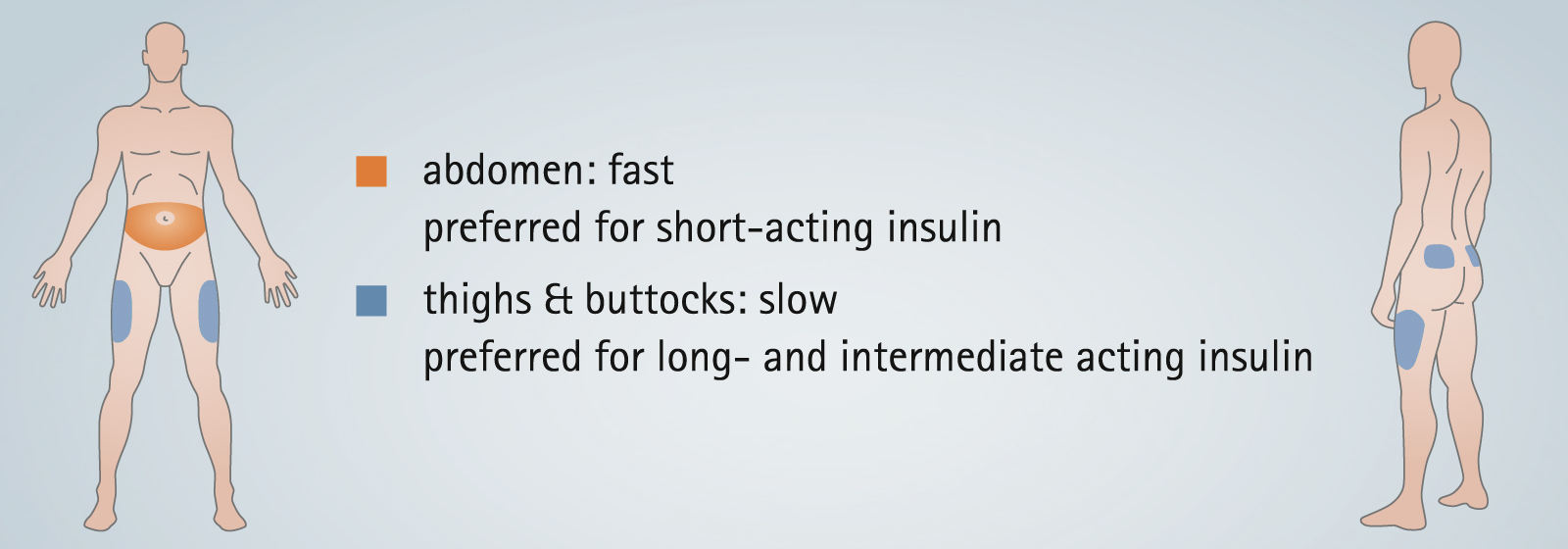 Injection Sites