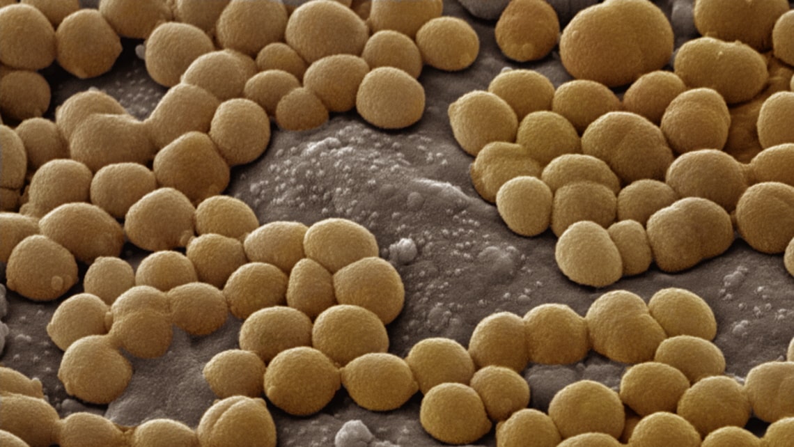 staphylococcus bacteria macro view