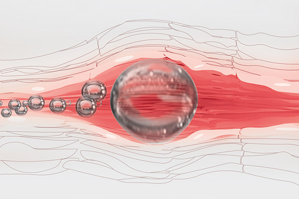 air embolism bubbles