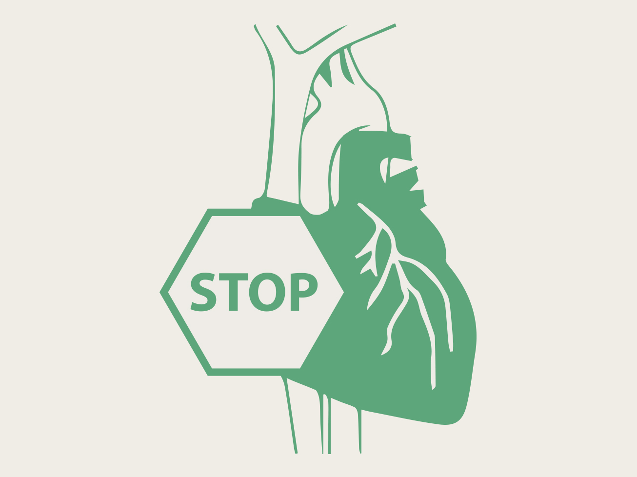 Air Embolism B. Braun