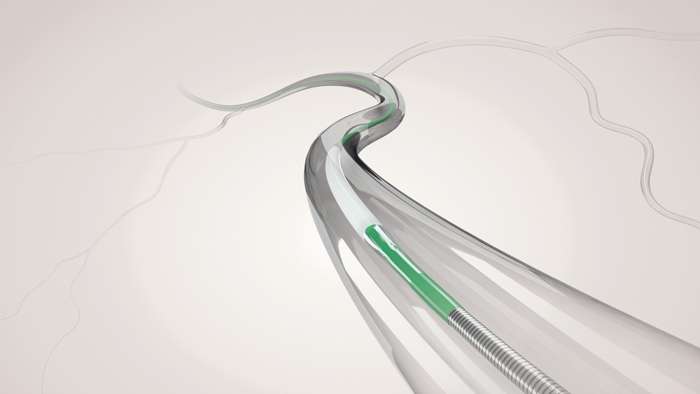 Use of a coronary drug-coated balloon for balloon angioplasty in a coronary artery.