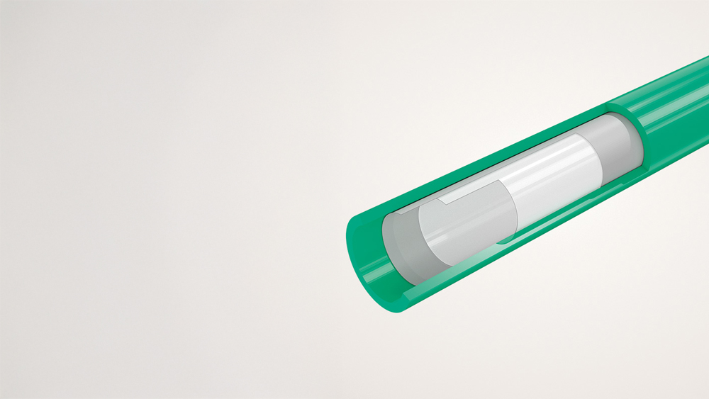Multi-layer lumen of a​ coronary drug-coated balloon catheter.