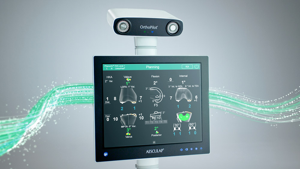 OrthoPilot surgical navigation system with a green data stream flowing into the device from the left and exiting on the right, symbolizing the continuous flow of data.
