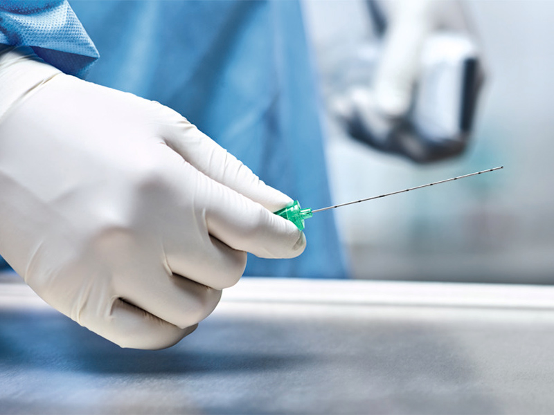 gloves hand of an anesthesiologist handling a peripheral nerve block needle by the grip while holding an ultrasound transducer with the other hand 