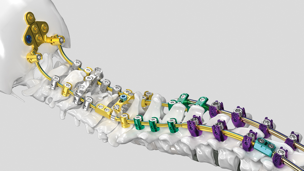 Spine model with Ennovate® Cervical