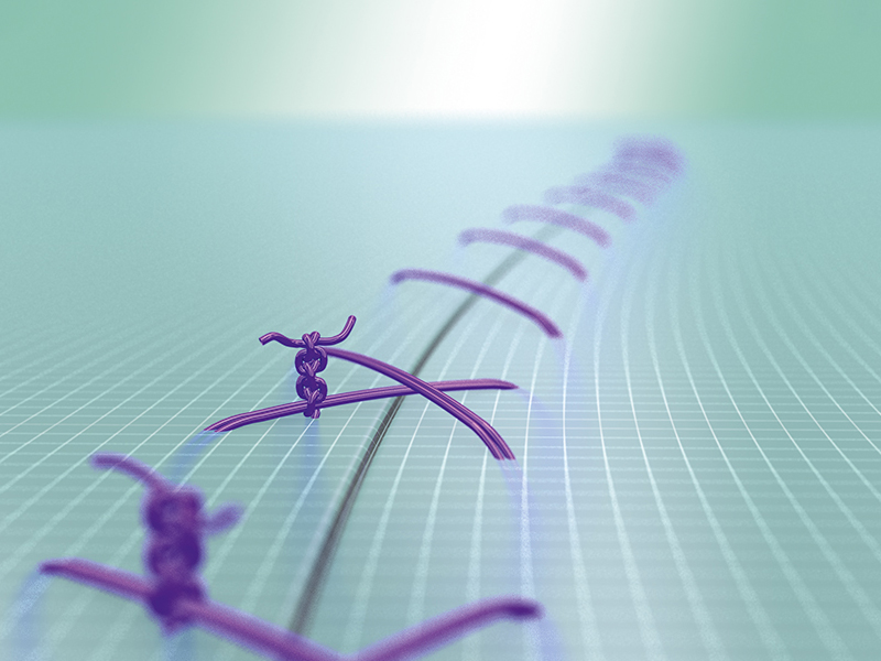 Illustration of a surgical suture knotting technique