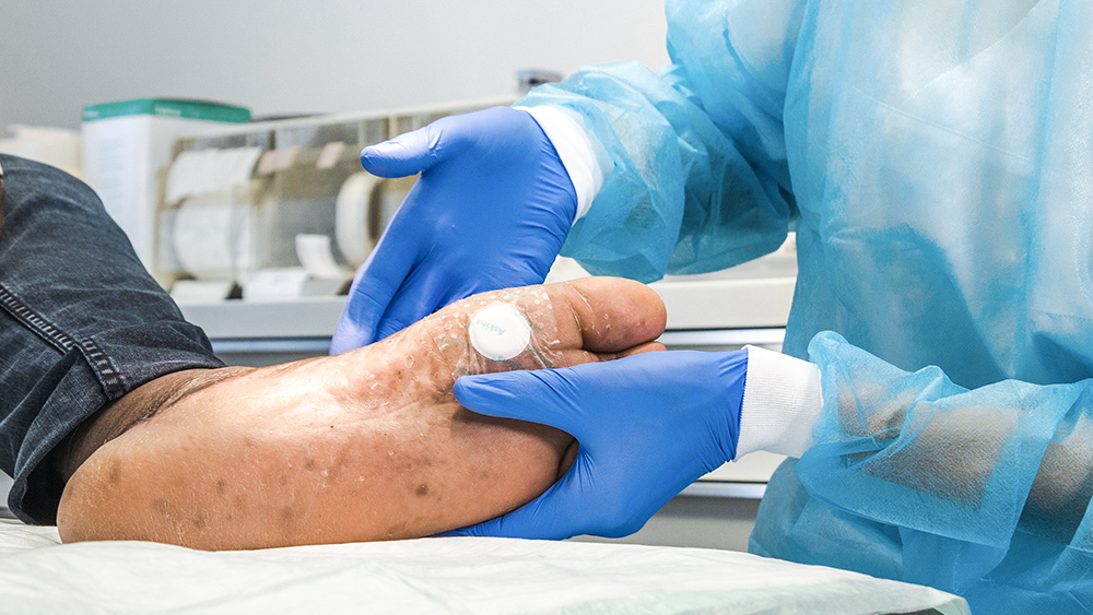 Two hands wearing gloves hold a diabetic foot with a plaster on it, in the background medical material in a medical room