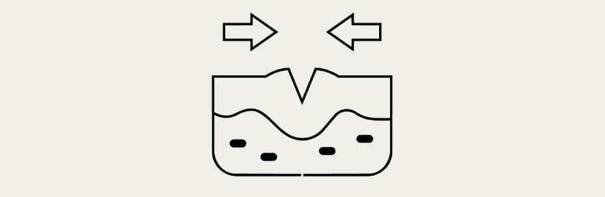 Illustration of a healing wound, with directional arrows highlighting the wound closure process and the reduction in wound size as healing progresses.