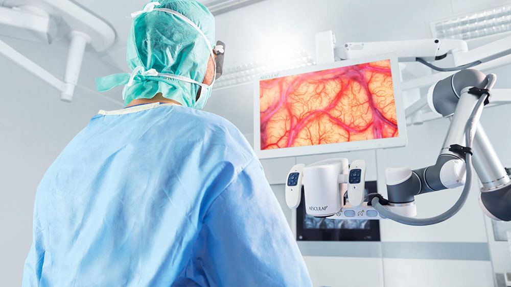A surgeon performs a neurosurgery with the Aesculap Aeos® while standing tall and looking at the monitor. 