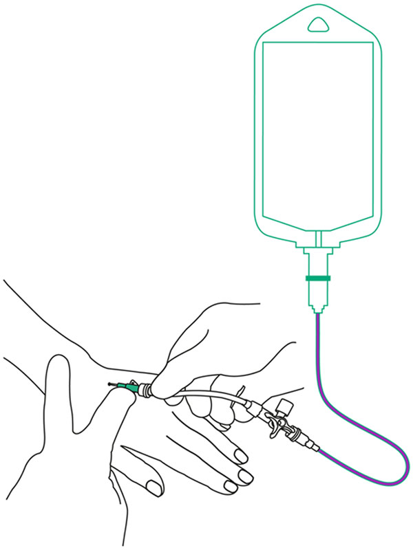 underdosage graphic