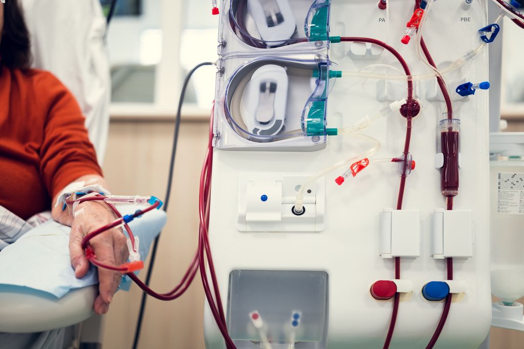hand of a middle-aged woman lies near the medical device and gets some medication through a few catheters