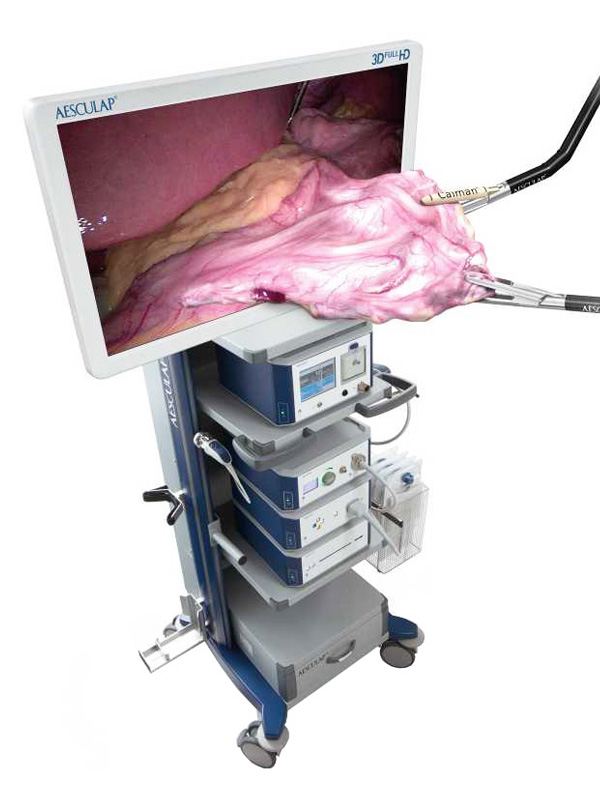 Laparoscopic surgery EinsteinVision® camera system with Caiman® advanced bipolar technology